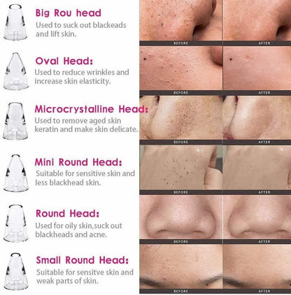 Blackheads remover Rechrgeable
